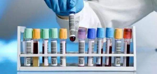 全自动血细胞分析仪检验的血液标本选择有不同