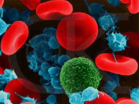 全自动血细胞分析仪:血常规的淋巴细胞